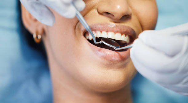 Best Emergency Dental Care for Broken or Chipped Teeth in Bristol, IN